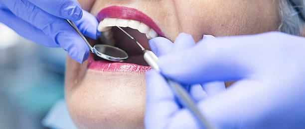 Best Walk-In Emergency Dentist in Fairlawn, VA